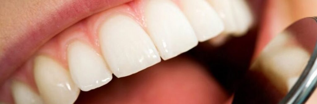 Periodoncia. Eliminar sarro y bacterias. Prevención de la gingivitis y periodontitis.