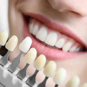 dientes mas blancos