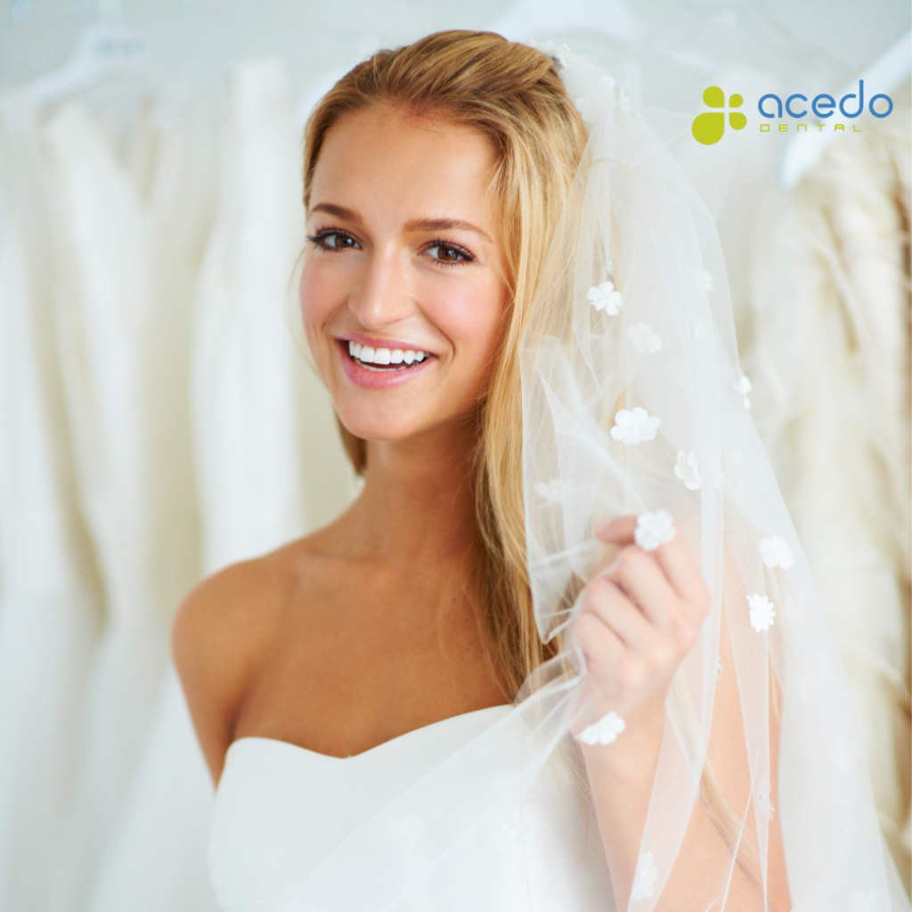 Estética dental Boda Clínica Acedo Dental Tratamientos dentales para antes de tu boda