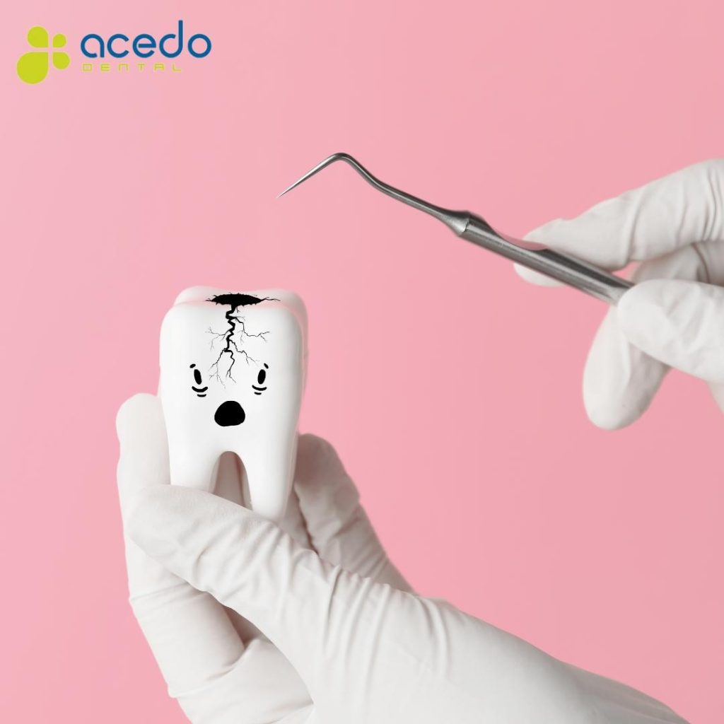Como quitar la sensibilidad dental Clínica dental Acedo Seseña Toledo Profesionales dentistas dientes mejores