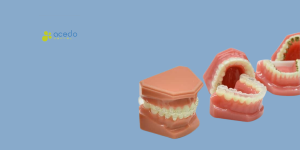 Apiñamiento dental