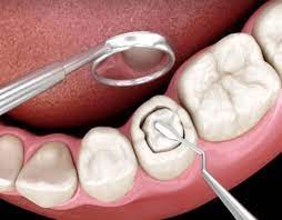 empaste dental acedo