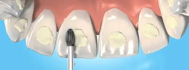 empaste dental