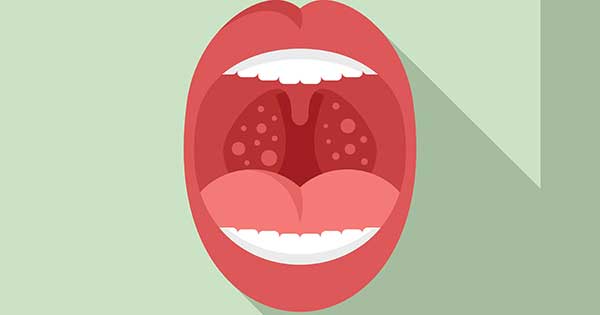 cancer oral
