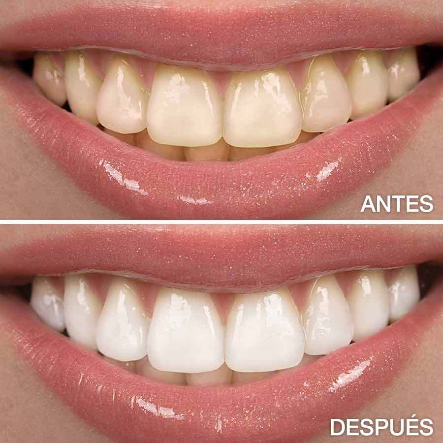 dientes más blancos