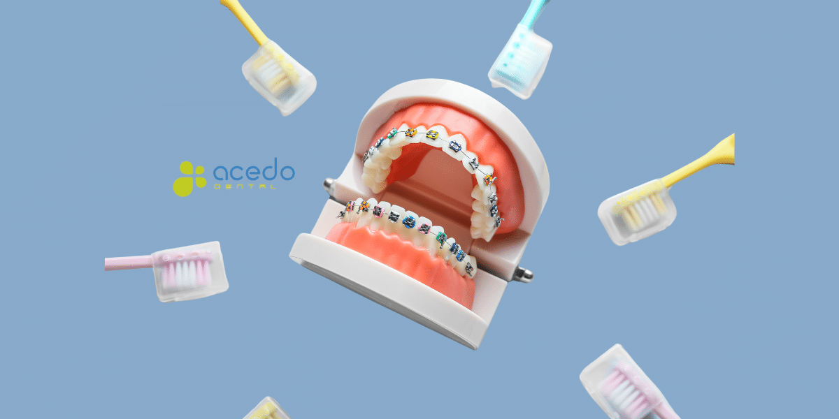 clínica dental acedo
