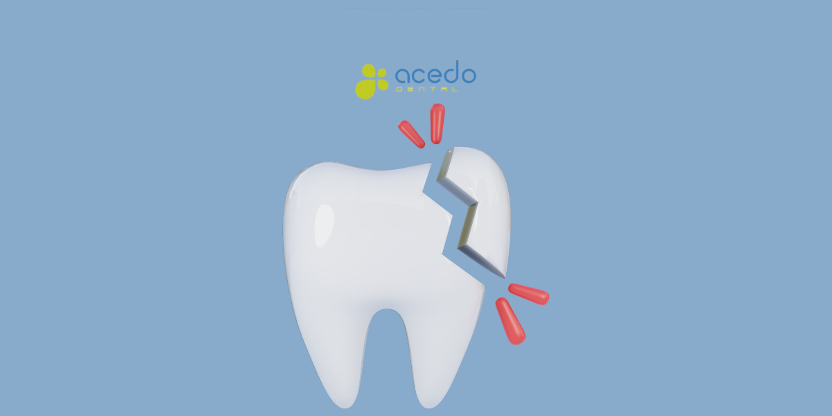 microfractura dental acedo blog