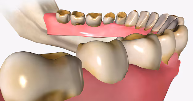erosión dental acedo