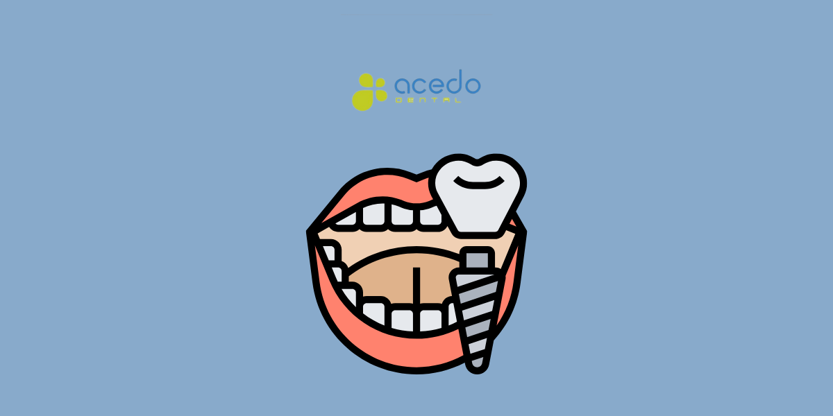 Cuidados tras implantes dentales