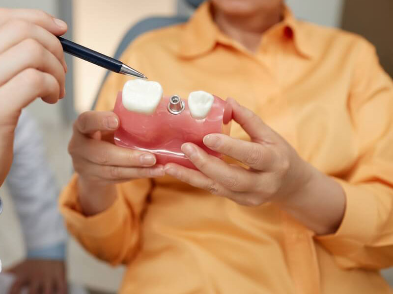 Cuidados tras implantes dentales