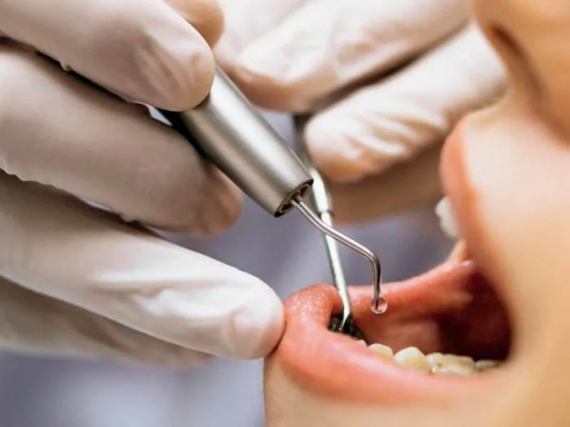 cómo elegir dentista en Seseña 