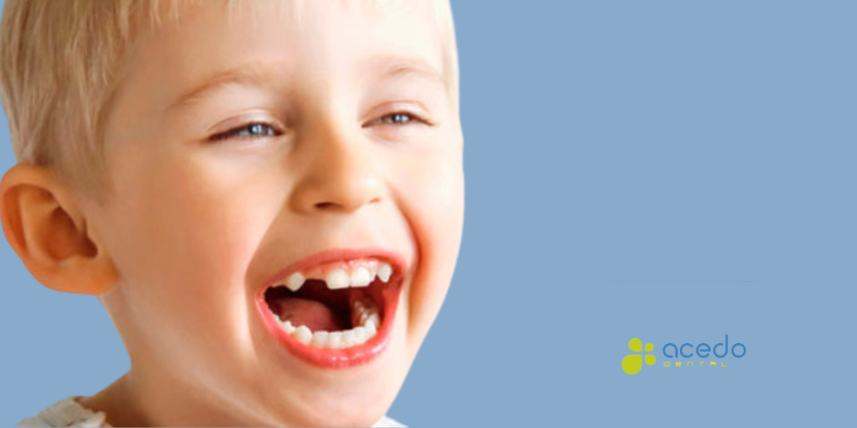 agenesia dental