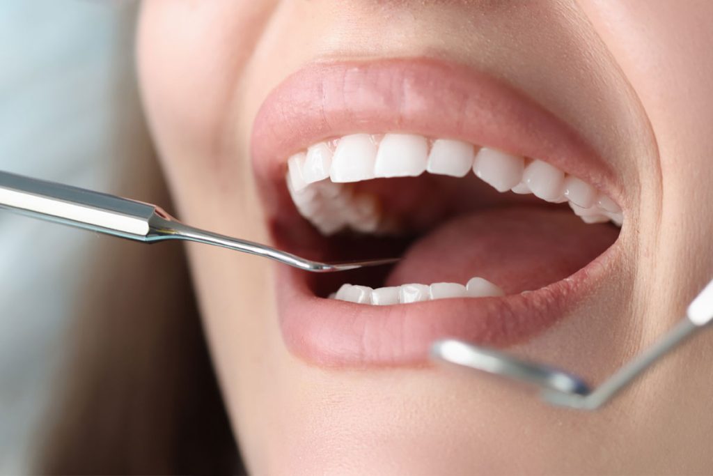 revisión dental